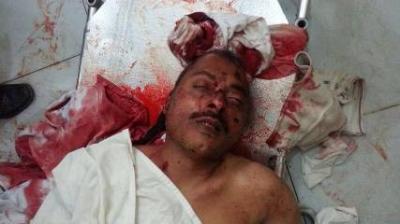 Almotamar Net - Director of Legal Affairs at the Central Organization for Control and Auditing (COCA) Branch in Ibb province Mohammad Hassan al-Musawa was shot dead by gunmen, a security source said on Tuesday.

The source explained that two gunmen on a motorbike opened fire on al-Musawa as he left his home this morning, heading to his workplace, which led to his death
