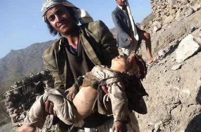 Almotamar Net - At least 11 people, mostly women and children, were killed on Friday in Saudi raids on Baqem district of Saada province, a security official said. 

The Saudi fighter jets targeted two houses in al-Zamah area, killing the eleven and injuring others, the official added. 
