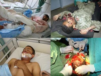 المؤتمر نت - من ضحايا جرائم الفرقة والاصلاح واولاد الاحمر بالعاصمة