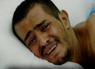 المؤتمر نت - خالد الذي جرح بشظايا قنابل العدوان في منطقه تهامة يعاني من تهتك اللحم وموت الانسجة والشرايين وصولا الى العظم بتأثير فتاك في غالبية الجسم في ظل استغراب الاطباء وعجزهم عن تقديم العلاج