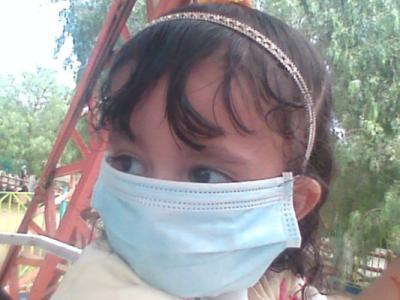 وفاة 79 وإصابة 293 بأنفلونزا الخنازير في اليمن 