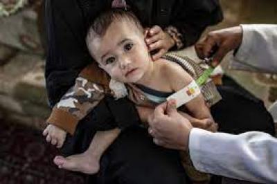 انقاذ 9 آلاف طفل يمني من سوء الغذية بـ6 أشهر	 