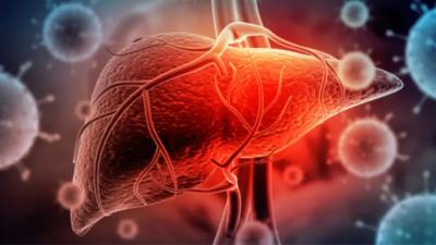   -      (NAFLD)          ϡ             