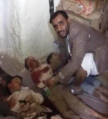Almotamar Net - Five children were killed on Monday in a bomblet blast in Sehar district of Saada province, a security official said. 

The bomblet exploded when children were playing in the district, the official pointed out.
