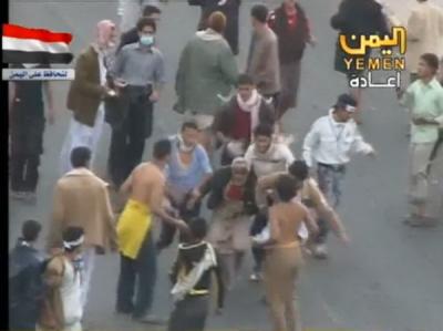 المؤتمر نت - عناصر المشترك تعتدي بوحشية على مواطن يمني