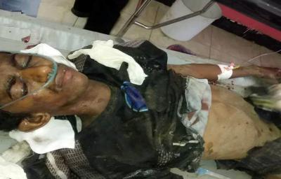 المؤتمر نت - أُصيب مواطن في مديرية الحوك بمحافظة الحديدة، اليوم، بجروح خطيرة نتيجة انفجار لغم من مخلفات تحالف العدوان 