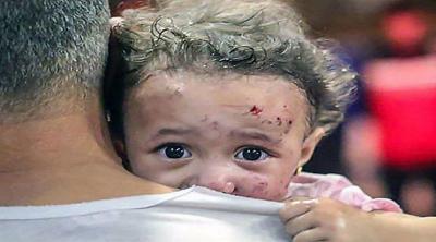 المؤتمر نت - أعلنت وزارة الصحة في غزّة، ارتفاع عدد شهداء العدوان الإسرائيلي على القطاع، إلى 15899، مبينةً أنّ 70% من الضحايا، هم من النساء والأطفال