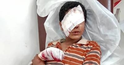 المؤتمر نت - أكد المركز التنفيذي للتعامل مع الألغام، أن مخلفات الحرب والقنابل العنقودية والألغام تواصل انتهاك الحق الأساسي في الحياة والعيش الآمن منذ بدء العدوان على اليمن في مارس 2015